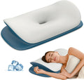 Olumoon Cervical Neck Pillow - Ergonomic Memory Foam Contour Pillows for Side, Back & Stomach Sleepers, Cervical Pillow for Neck Support Sl…